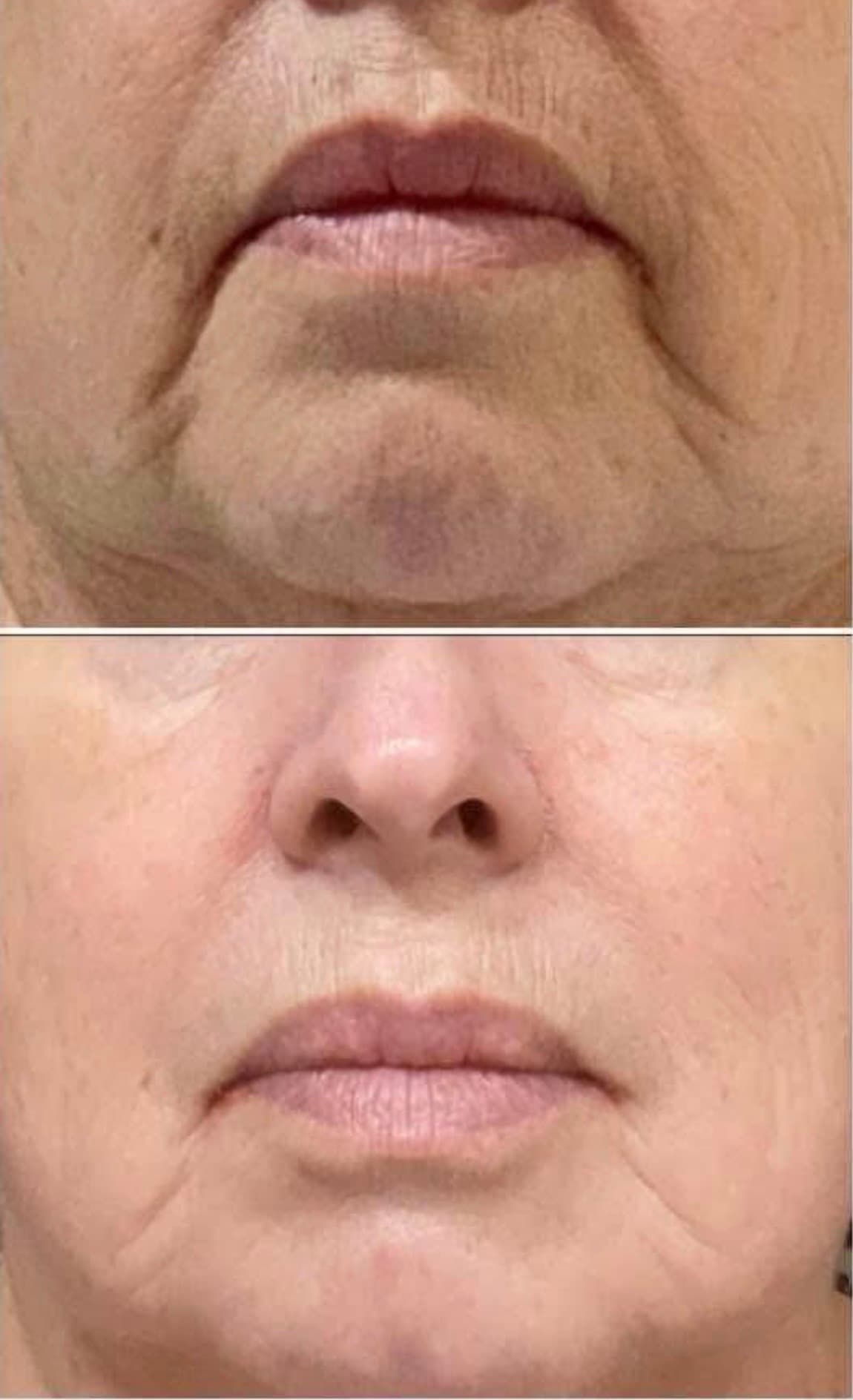 Calmanesa Liposomal Glutathione + Marine Collagen